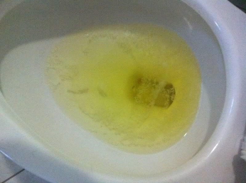 Anyone Else Pee And Have Stuff Float At The Top(SRS - 799x596 - jpeg