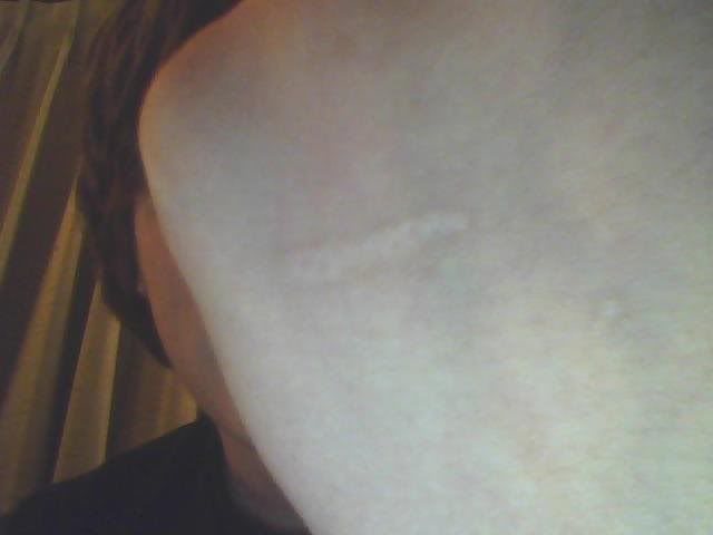 http://i271.photobucket.com/albums/jj146/grahaam/lefthandblisterandtriangle.jpg