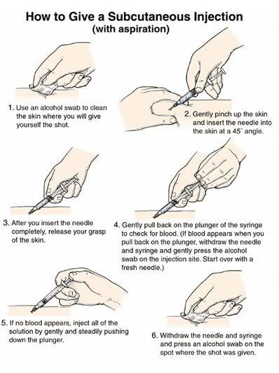 how-to-give-a-subcutaneous-injection-market-street-medical-practice